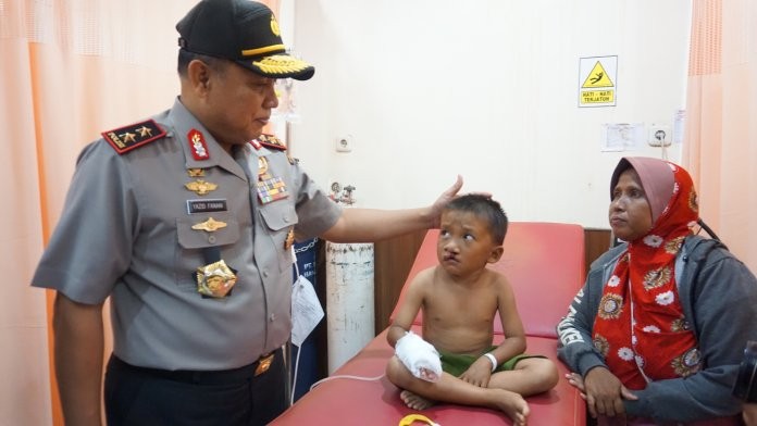 29 Pasien Ikuti Senyum Bersama Polri