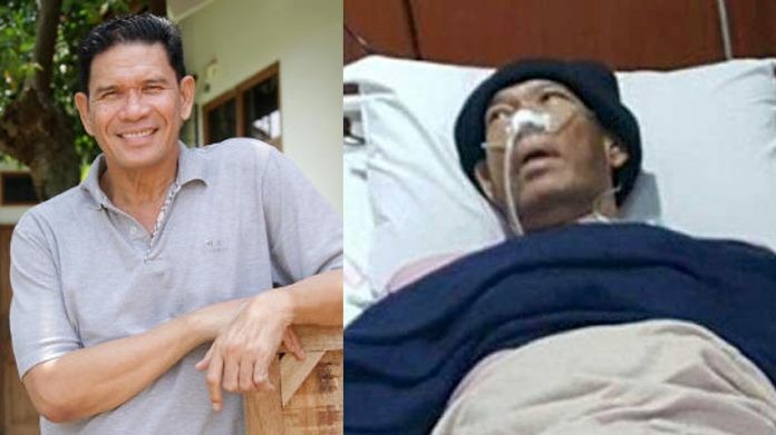 Aktor Laga Advent Bangun Tutup Usia