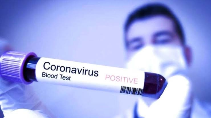 Update Korban Wabah Corona China: 304 Tewas, 322 Sembuh