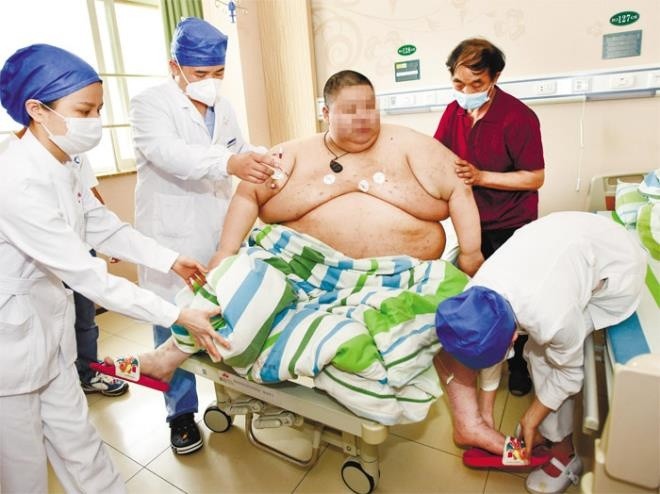 Bobot Pria Ini Bertambah 100 Kg Selama Lockdown Lima Bulan