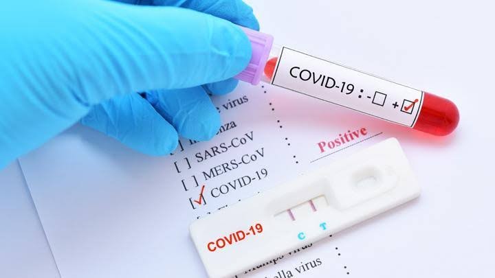 Kemenkes dan BPKP Sepakati Harga Tertinggi Rapid Test Antigen Swab