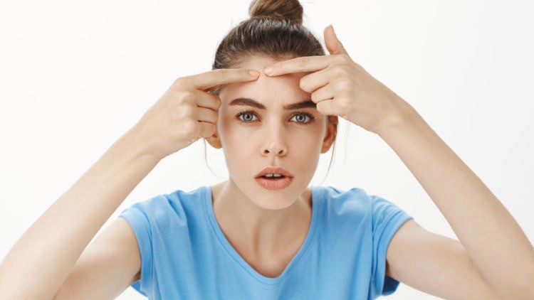 Ini Tips Menyamarkan Jerawat dengan Makeup