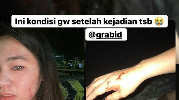 Wanita Diduga Dianiaya Pengemudi Taksi Online Hingga Babak Belur, Polisi Kejar Pelaku