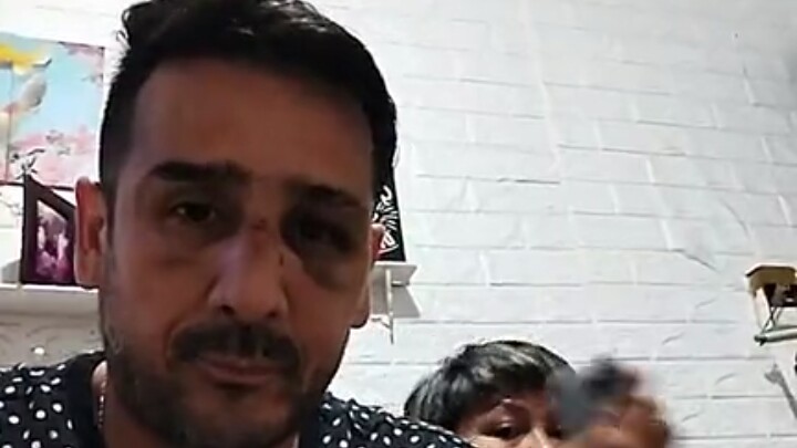 Polisi Dalami Kasus Dugaan Penganiayaan yang Menimpa Mantan Pesepak Bola Claudio Martinez