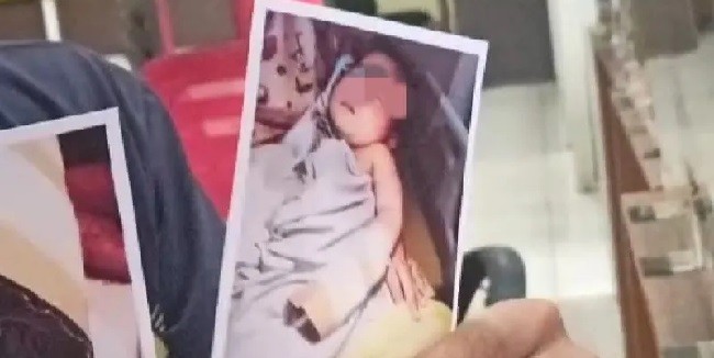 Keluarga Bayi yang Jarinya Tergunting Siap Damai, Jika...