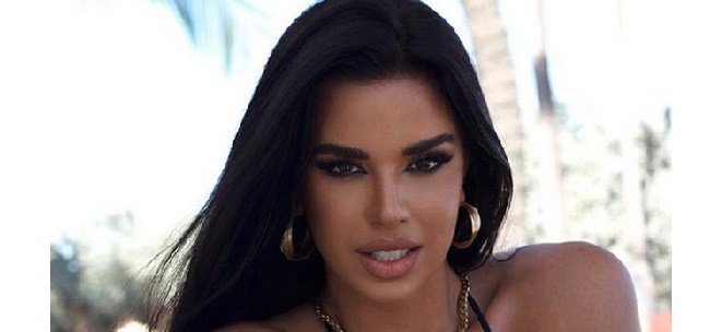 Ivana Knoll Ejek Manchester United Usai Kalah dari Liverpool
