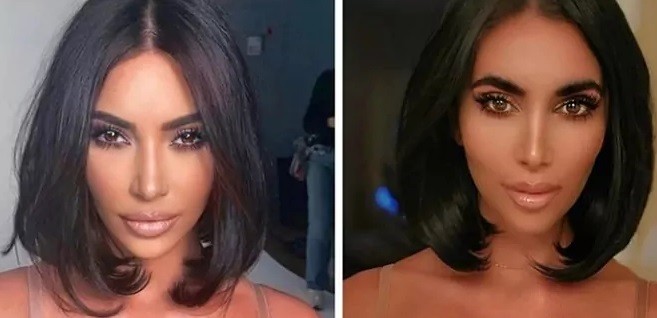 Demi Serupai Kim Kardashian, Ashten Habiskan Ribuan Dolar untuk Operasi