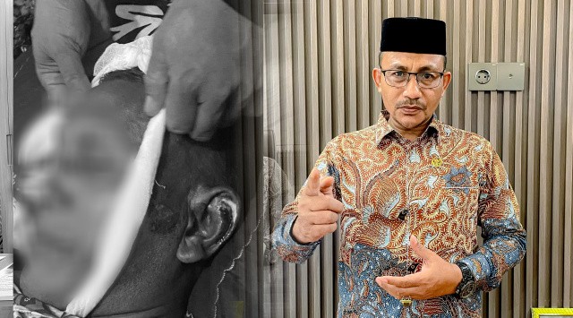 Warga Aceh Utara Meninggal Dunia Diduga Akibat Dianiaya Oknum Polisi, H. Uma Minta Polda Aceh Tangani Serius