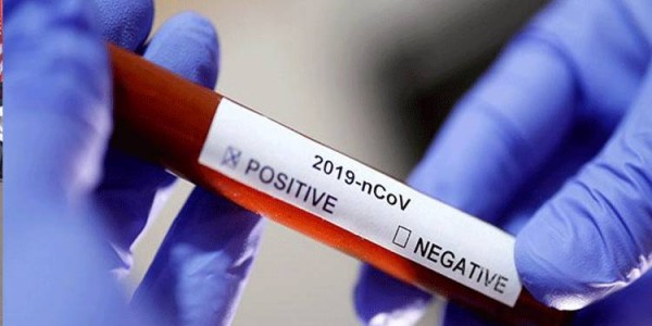 Setelah Dites Lab, Pasien Terduga Corona di Batam Dinyatakan Negatif