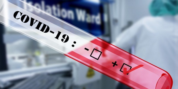 DPR Desak Pemerintah Segera Realisasikan Produksi Massal Alat Deteksi COVID-19