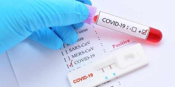 Kemenkes dan BPKP Sepakati Harga Tertinggi Rapid Test Antigen Swab