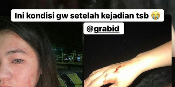 Wanita Diduga Dianiaya Pengemudi Taksi Online Hingga Babak Belur, Polisi Kejar Pelaku