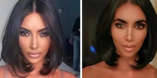 Demi Serupai Kim Kardashian, Ashten Habiskan Ribuan Dolar untuk Operasi