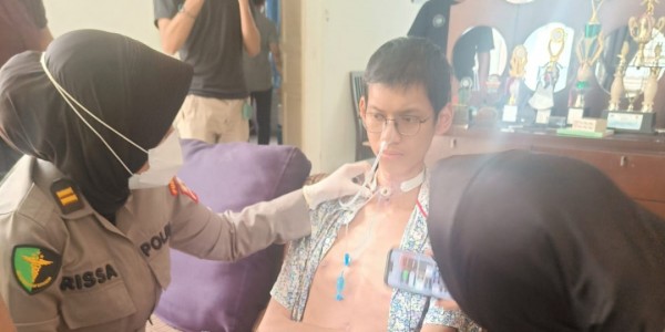 Kapolri Instruksikan RS Polri dan Kapolres Jaksel Bantu Mahasiswa Korban Terjerat Kabel di Antasari