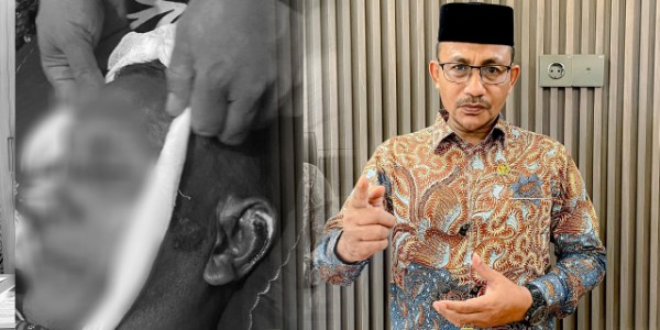 Warga Aceh Utara Meninggal Dunia Diduga Akibat Dianiaya Oknum Polisi, H. Uma Minta Polda Aceh Tangani Serius