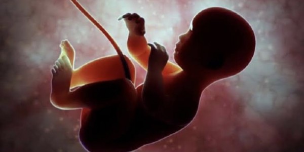 Aborsi Bagi Korban Pemerkosaan Menurut Dosen Hukum Pidana Unair